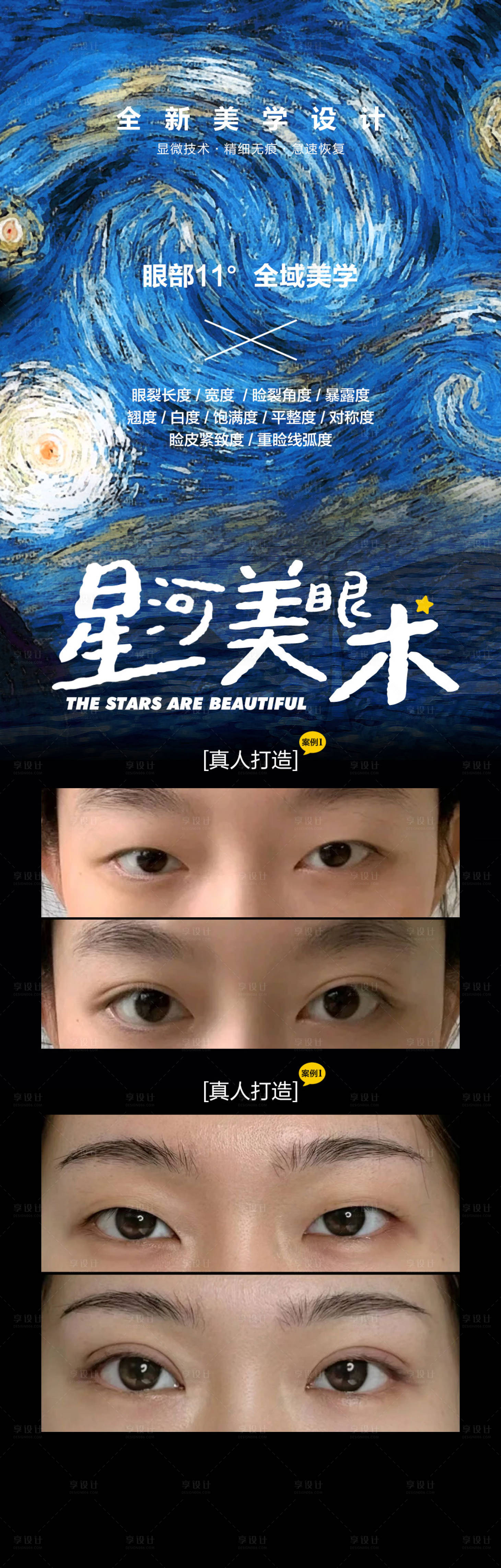 源文件下載【享設計】搜索編號：50670025700263969【雙眼皮科普】