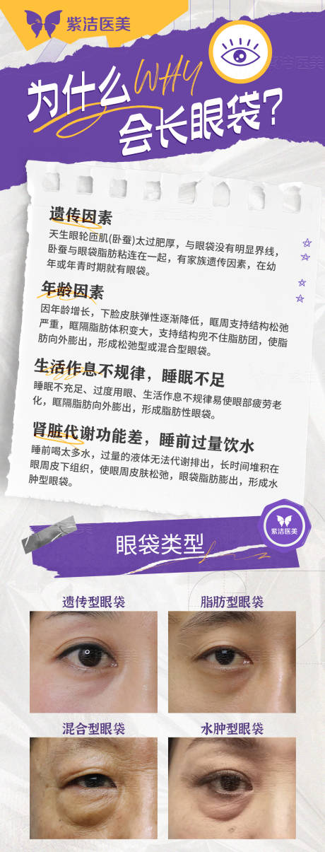 源文件下载【为什么会长眼袋】编号：93970025824165944