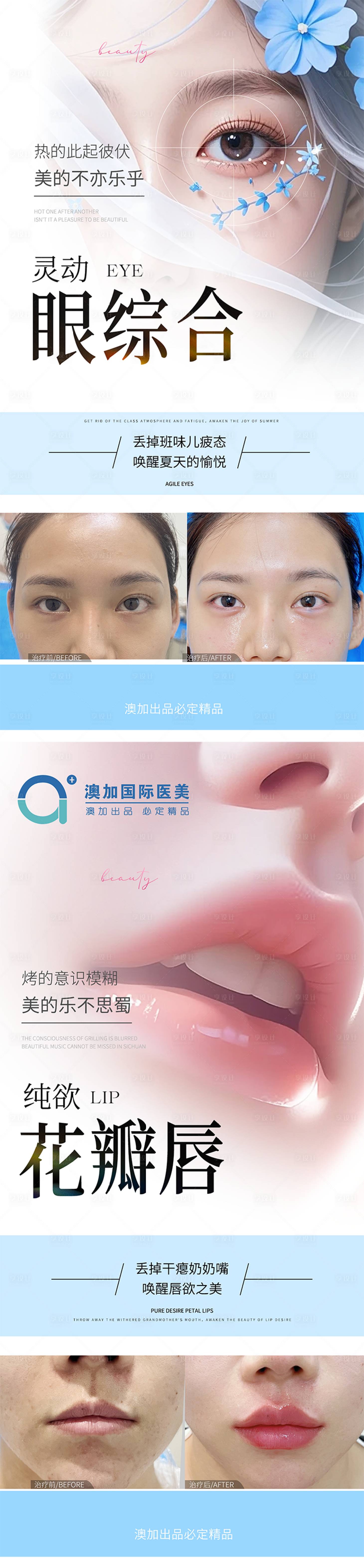 源文件下载【享设计】搜索编号：66730025534123821【医美案例】