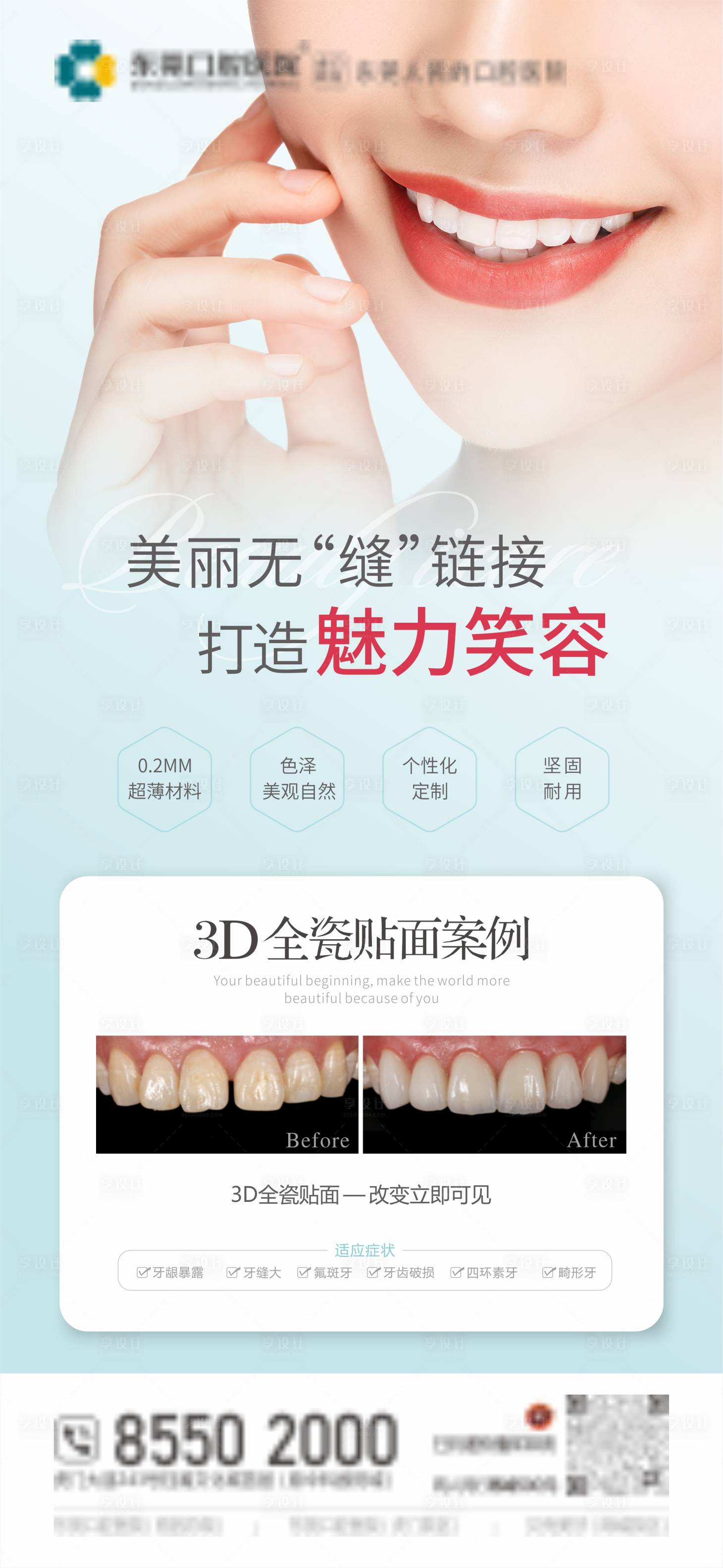 源文件下载【享设计】搜索编号：71660025919776471【口腔全瓷贴面海报】