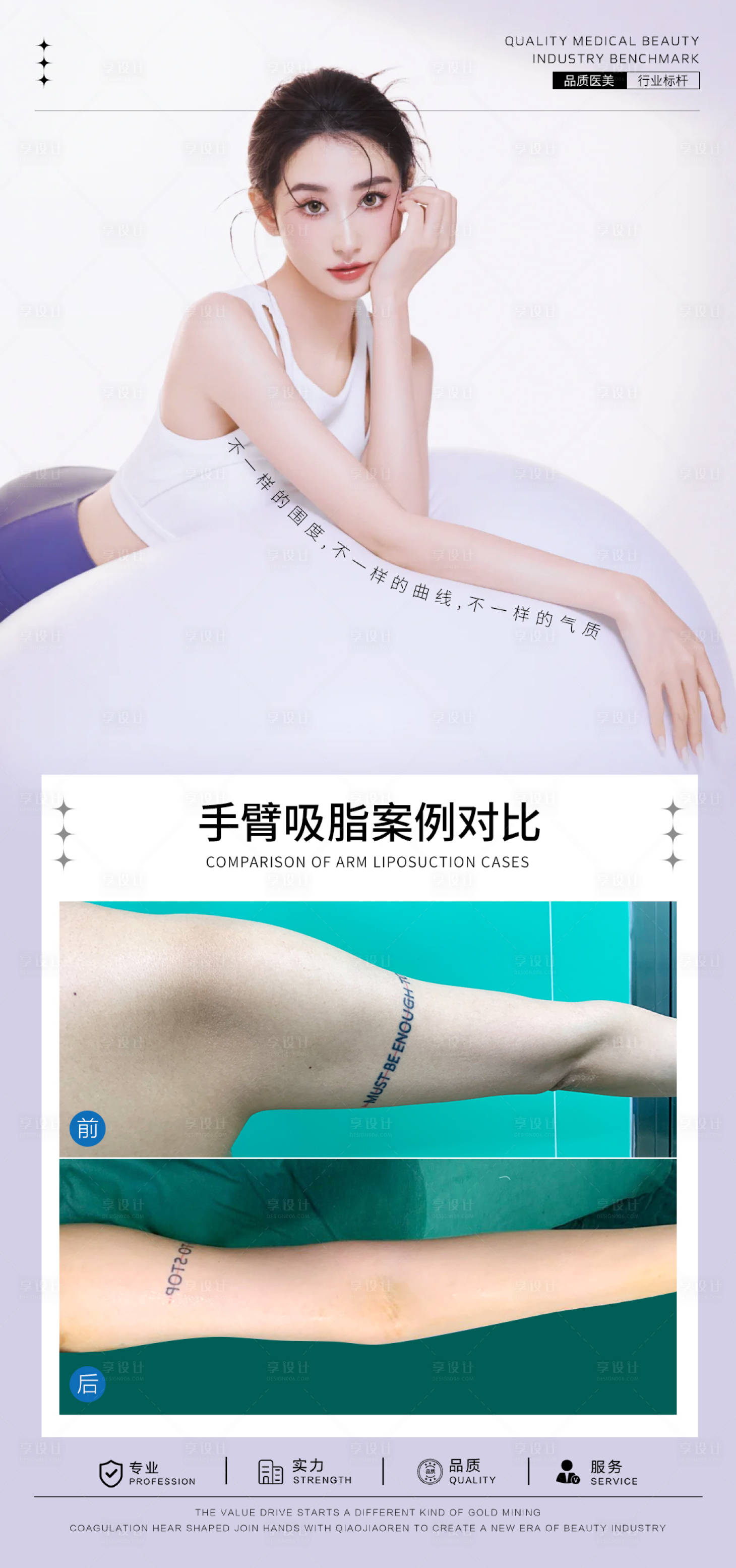 源文件下载【享设计】搜索编号：17520025868537311【手臂吸脂案例对比图】