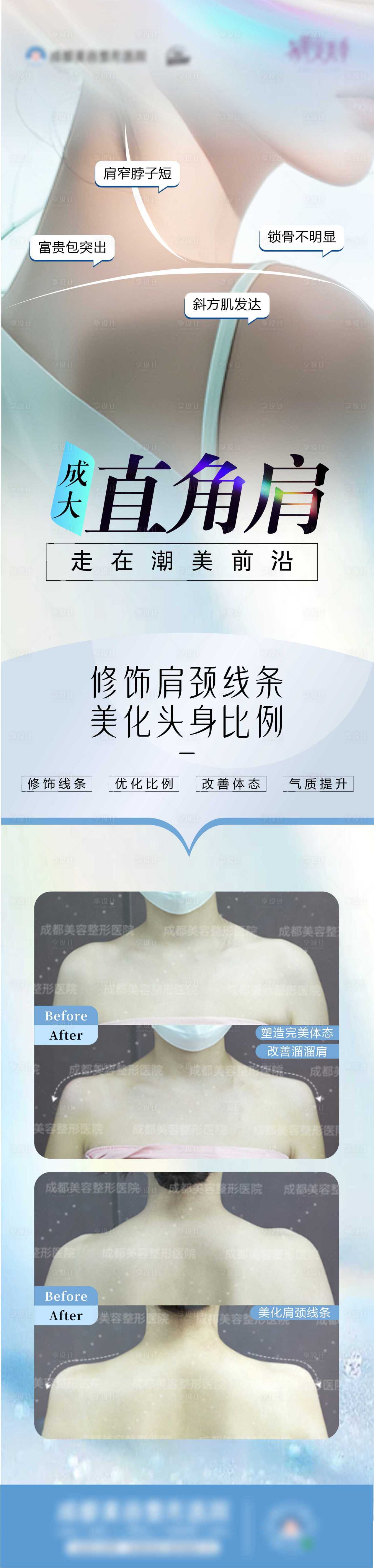 源文件下载【直角肩】编号：85660025726505622