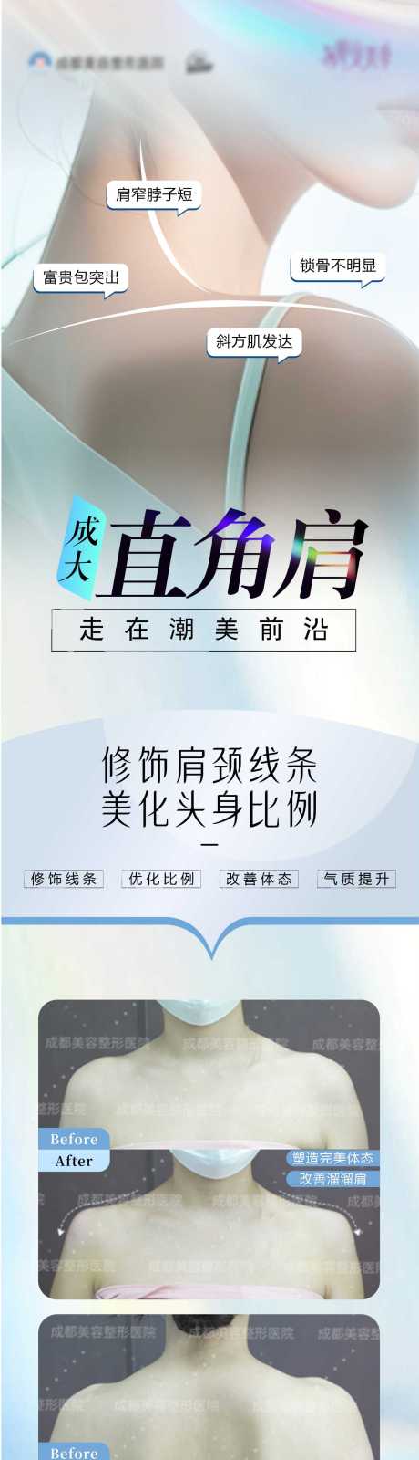 源文件下载【直角肩】编号：85660025726505622