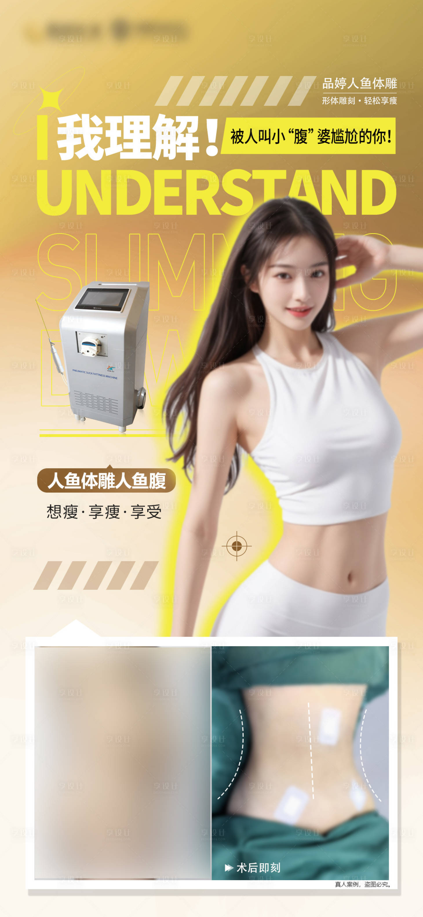 源文件下載【享設(shè)計(jì)】搜索編號(hào)：73830025766343829【馬甲線案例海報(bào)（TIF用PS打開(kāi)）】