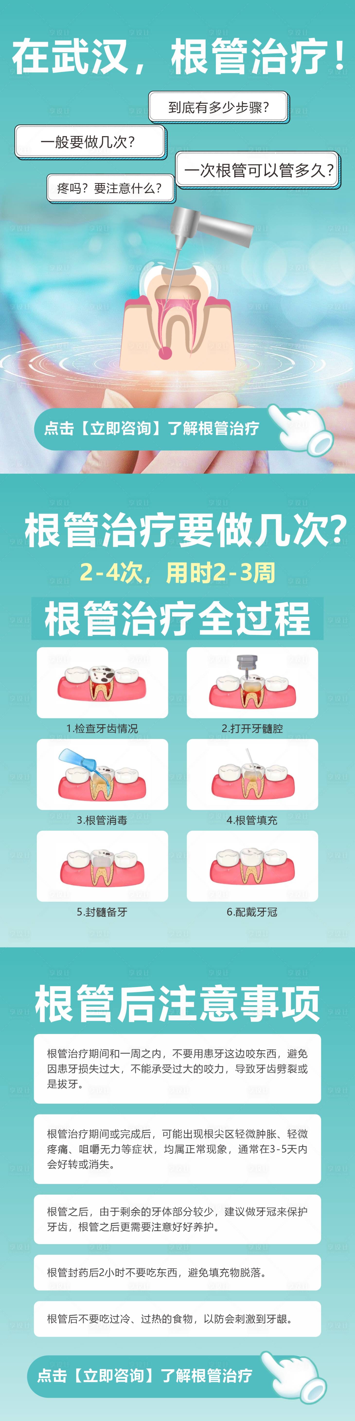 源文件下載【享設計】搜索編號：29970025746827414【口腔牙科根管治療海報長圖】