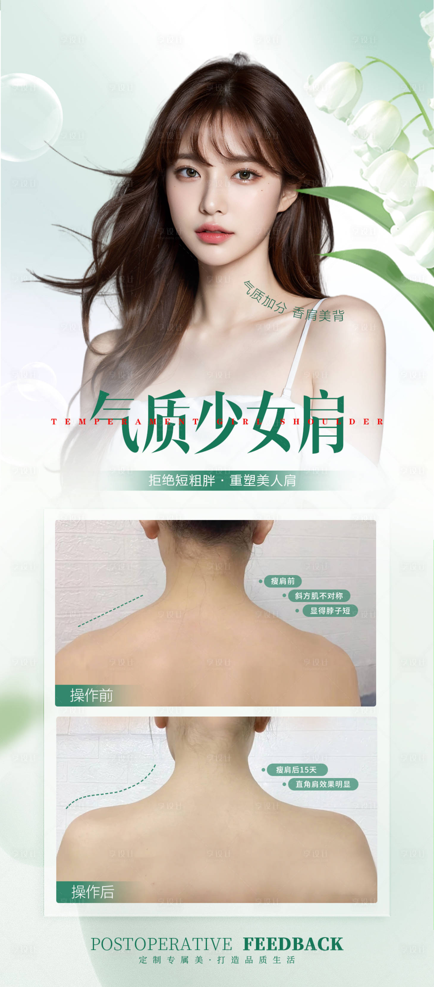 源文件下載【享設計】搜索編號：51990025857487625【醫美少女肩整形案例海報】