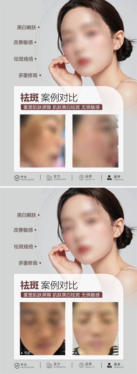 源文件下载【医美祛斑案例海报】编号：67460025500674593
