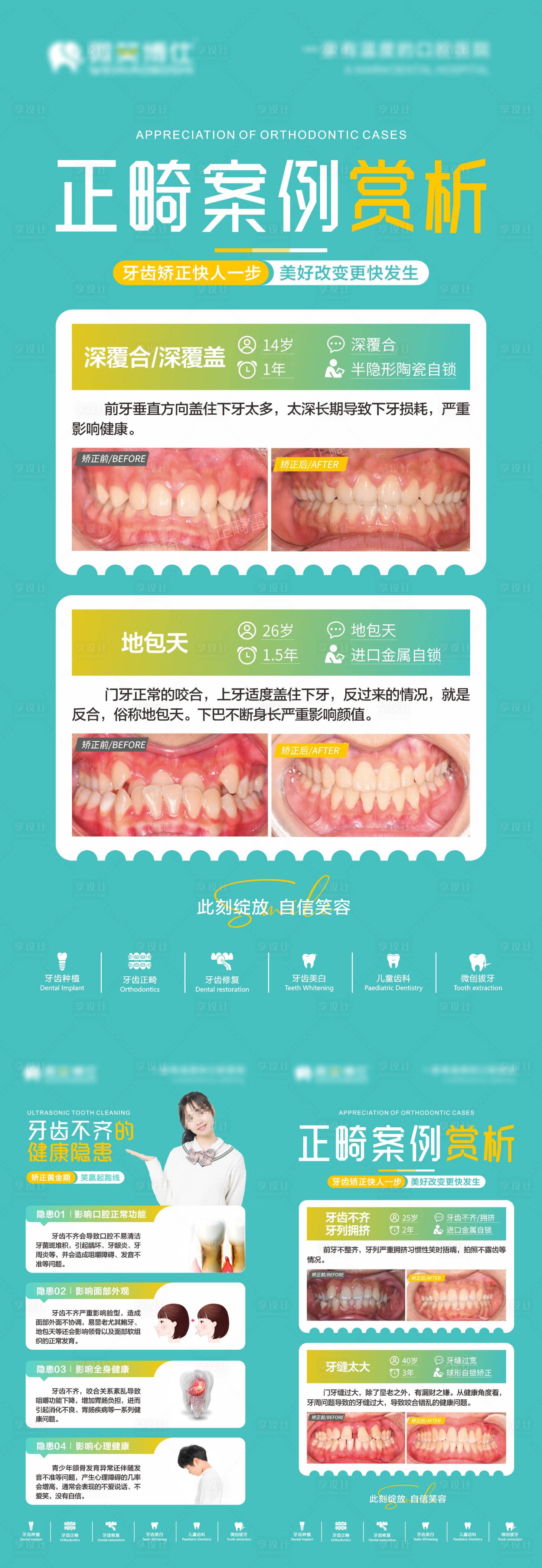 源文件下载【享设计】搜索编号：84960026346558828【儿童正畸系列海报】