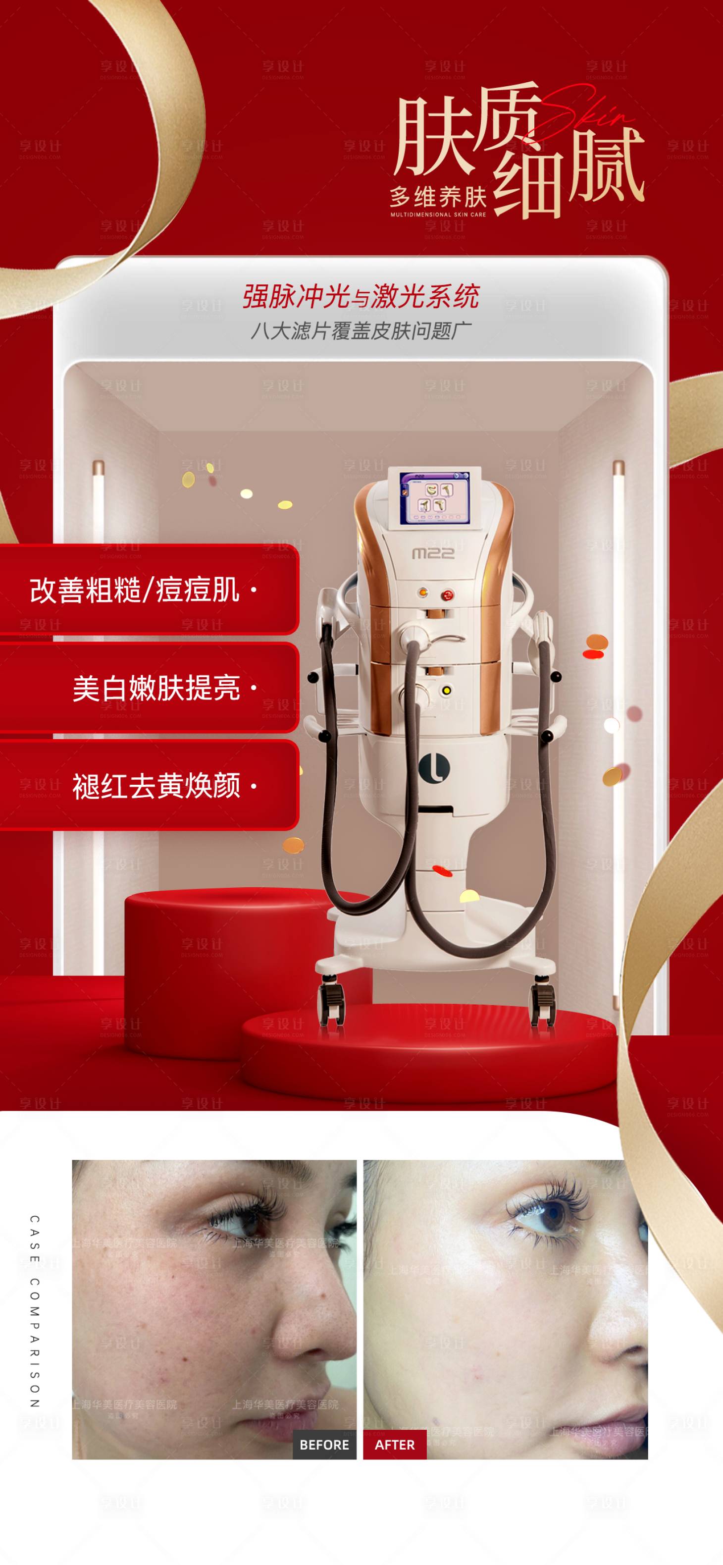 源文件下载【享设计】搜索编号：70140026274908961【医美活动海报】