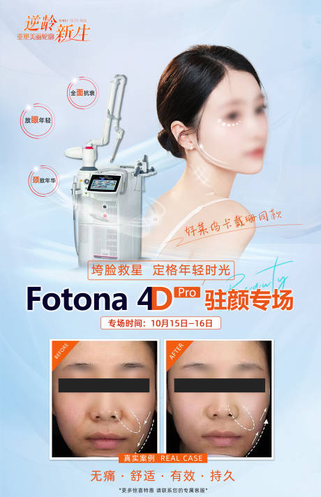 源文件下载【FOTONA 4D专场】编号：80600026477798852