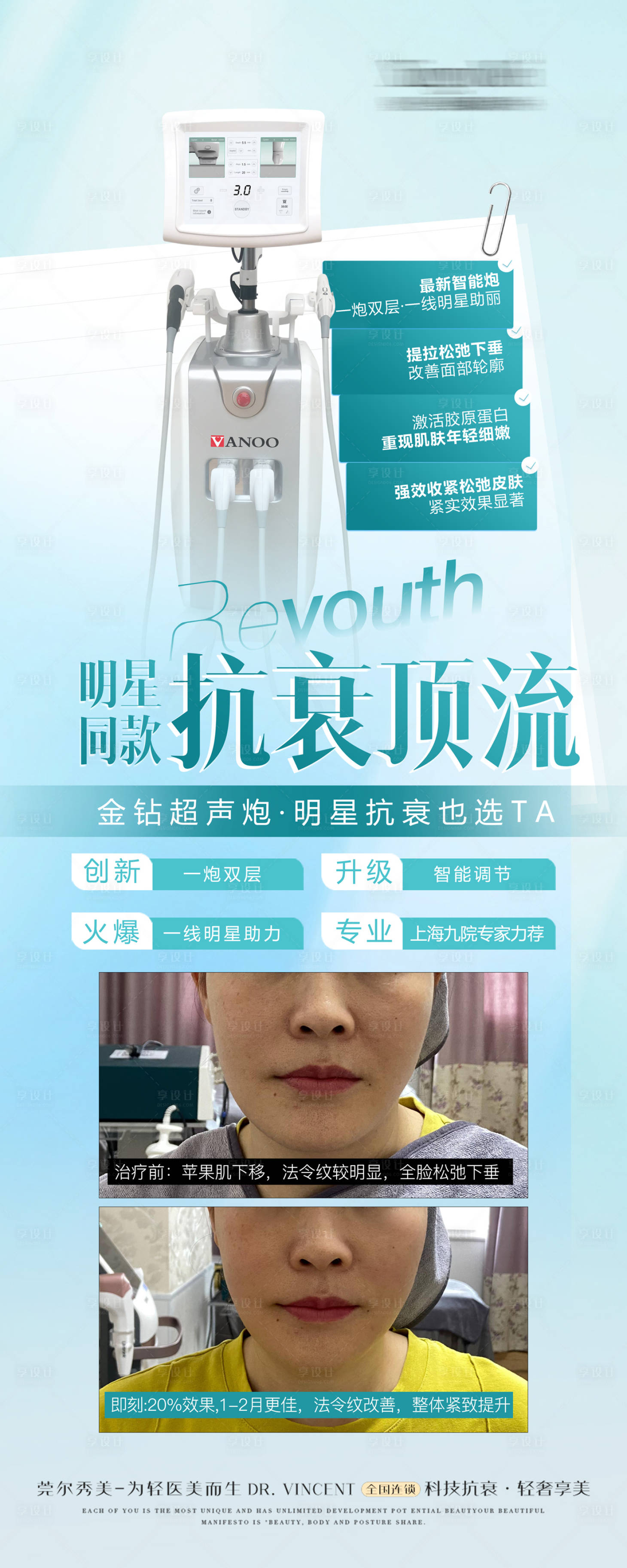 源文件下载【享设计】搜索编号：53170026392695762【金钻超声炮展架】