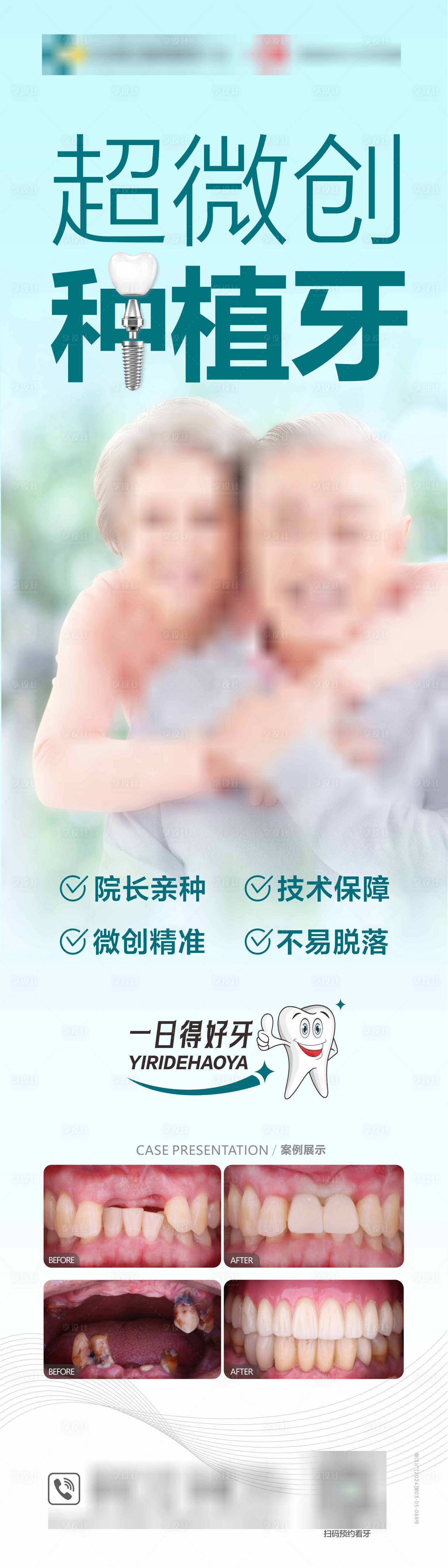 源文件下载【享设计】搜索编号：11130026447595638【口腔种植牙长图】