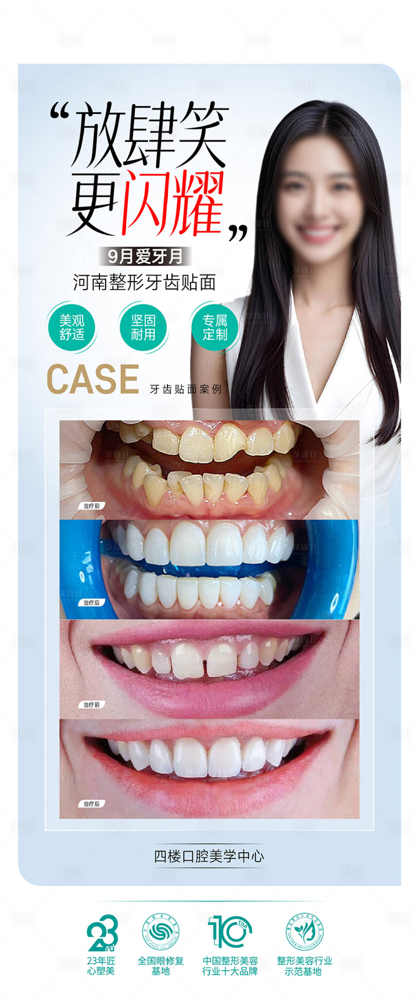 源文件下載【口腔整形海報(bào)設(shè)計(jì) 】編號(hào)：34190026093119427