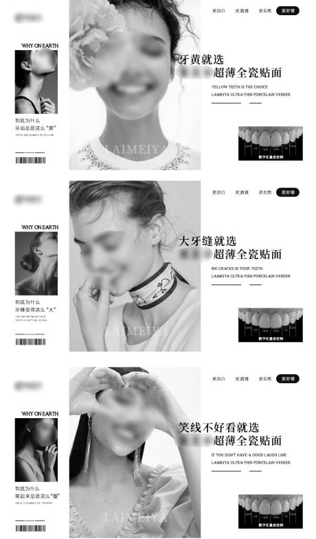 源文件下载【口腔美学牙齿超薄banner】编号：25340026349421099