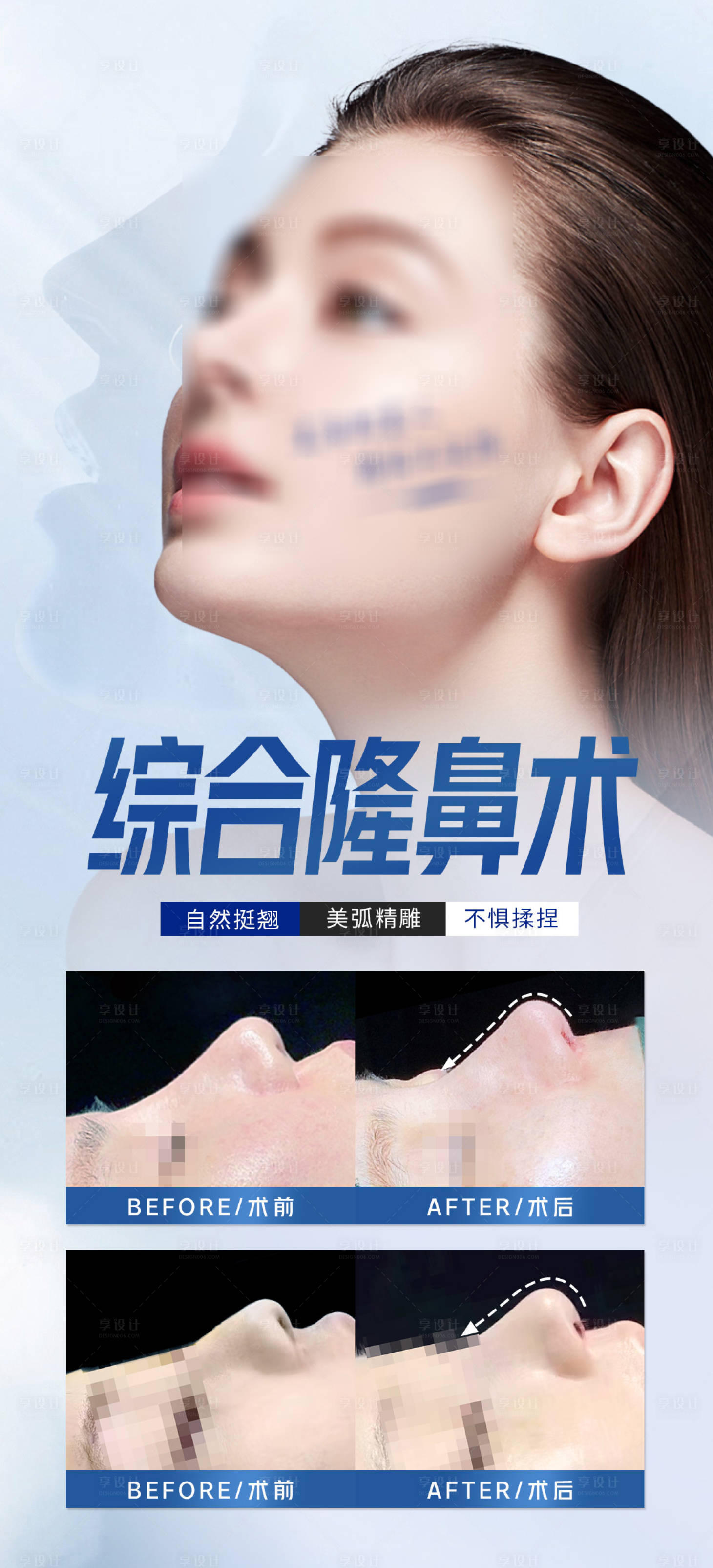 源文件下載【享設(shè)計(jì)】搜索編號(hào)：14320026017552913【醫(yī)美整形項(xiàng)目】