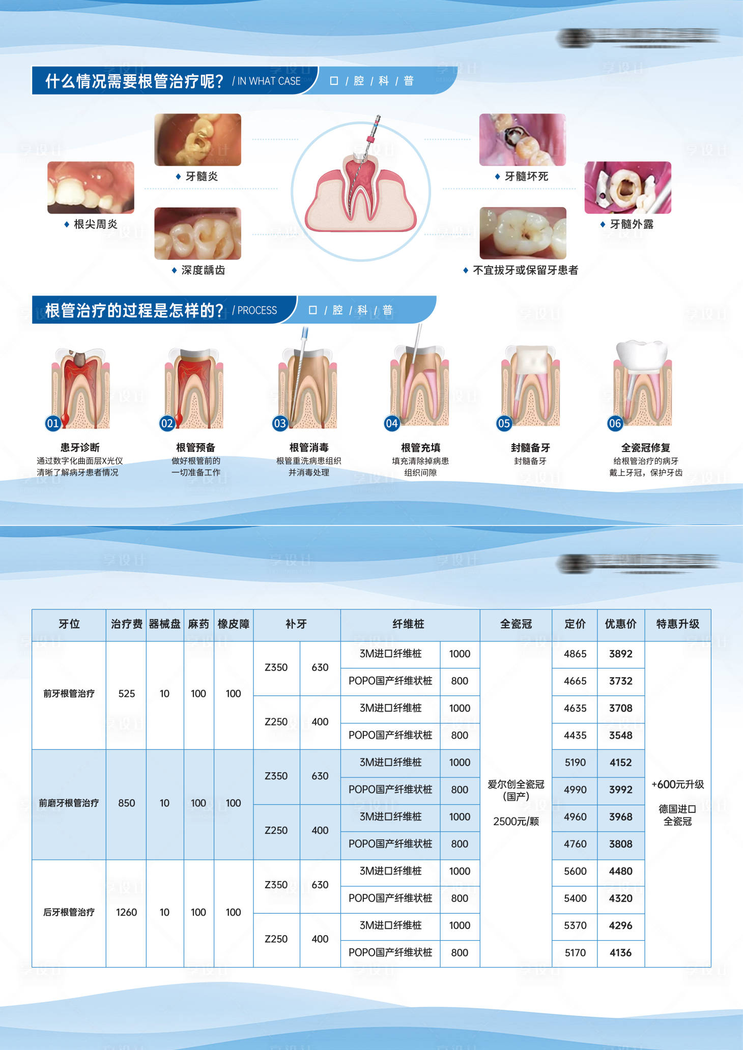 源文件下载【根管治疗步骤科普】编号：83390026299897141