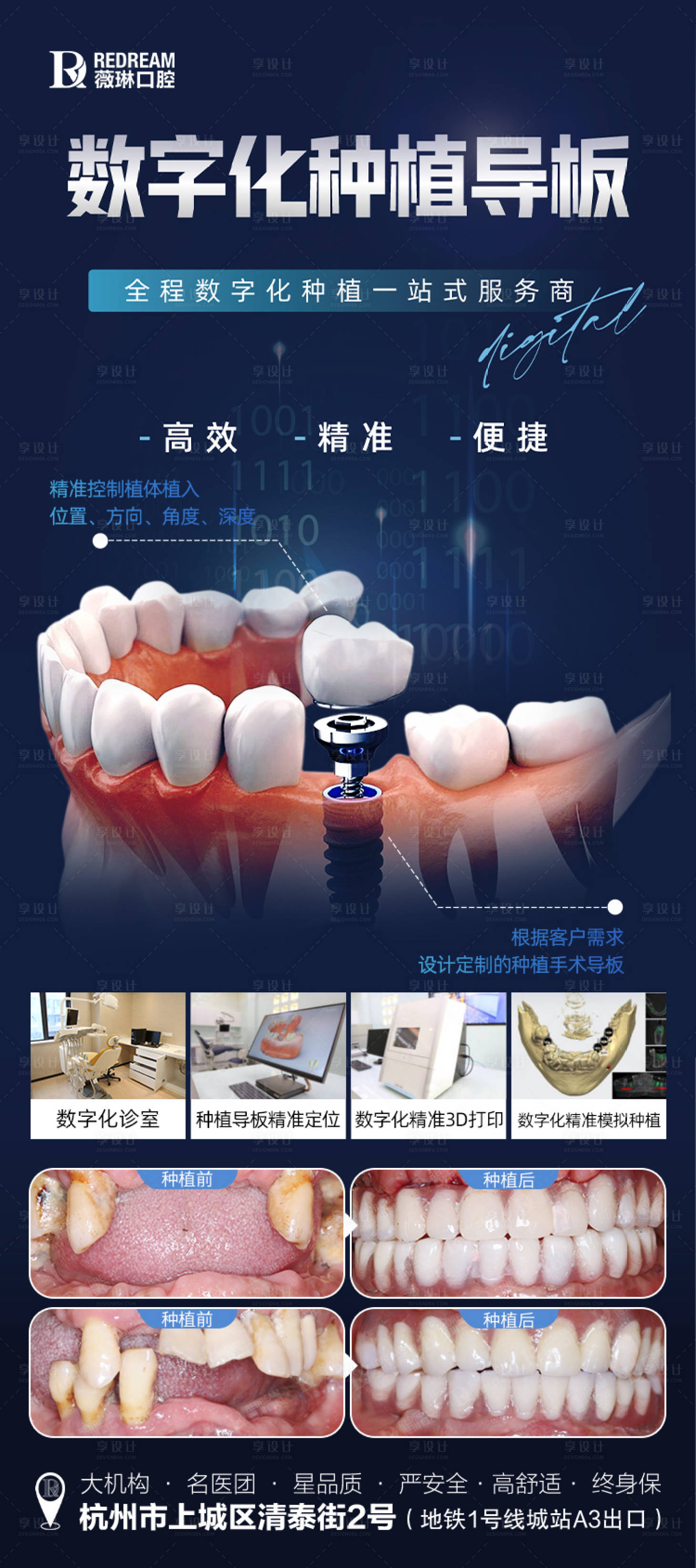 源文件下载【享设计】搜索编号：29670026443487567【口腔种植牙海报】