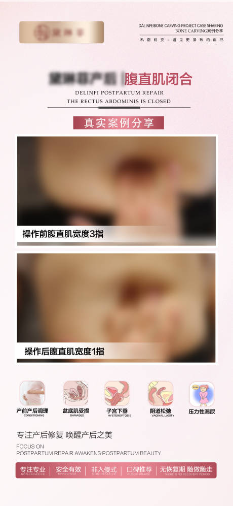 源文件下载【私密产后修复案例】编号：87500026373106318