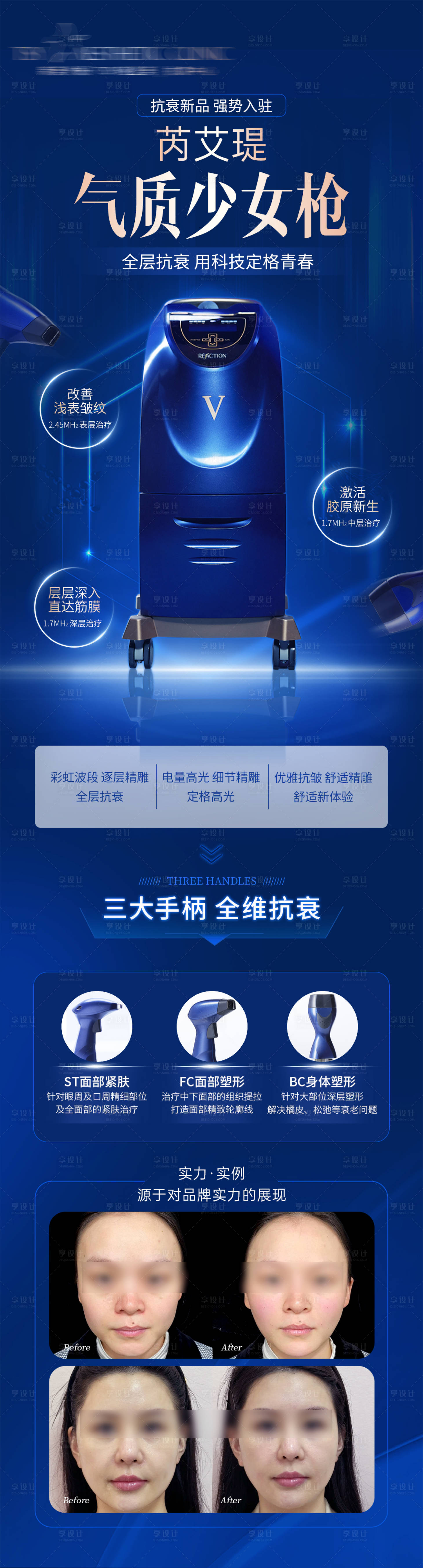 源文件下载【医美少女枪简介长图】编号：85000026441757954