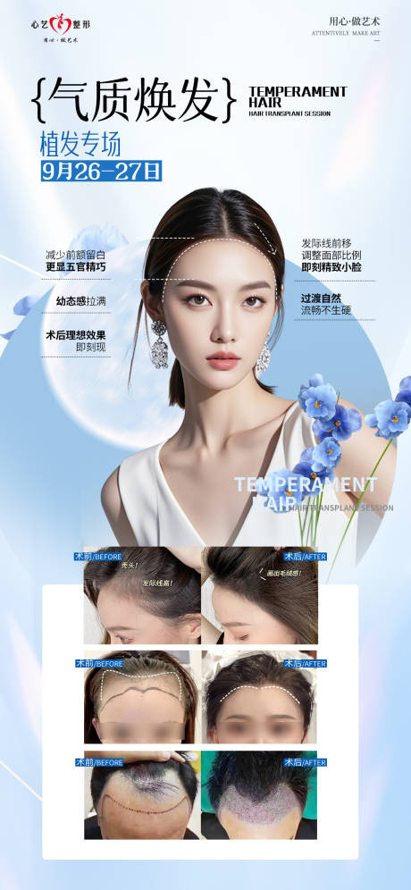 源文件下載【享設(shè)計(jì)】搜索編號：42870026405251909【氣質(zhì)煥發(fā)植發(fā)專場宣傳海報(bào)】