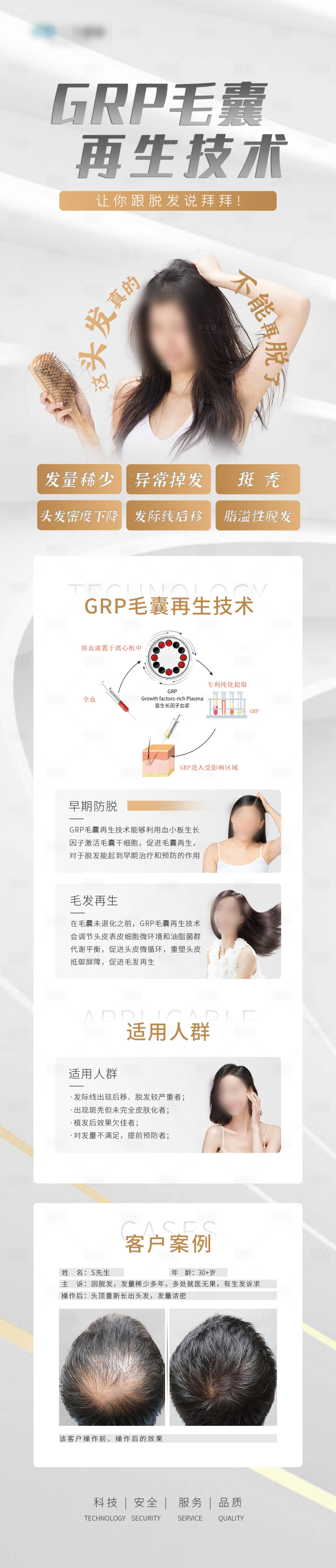源文件下载【享设计】搜索编号：22460026551256173【植发宣传海报】
