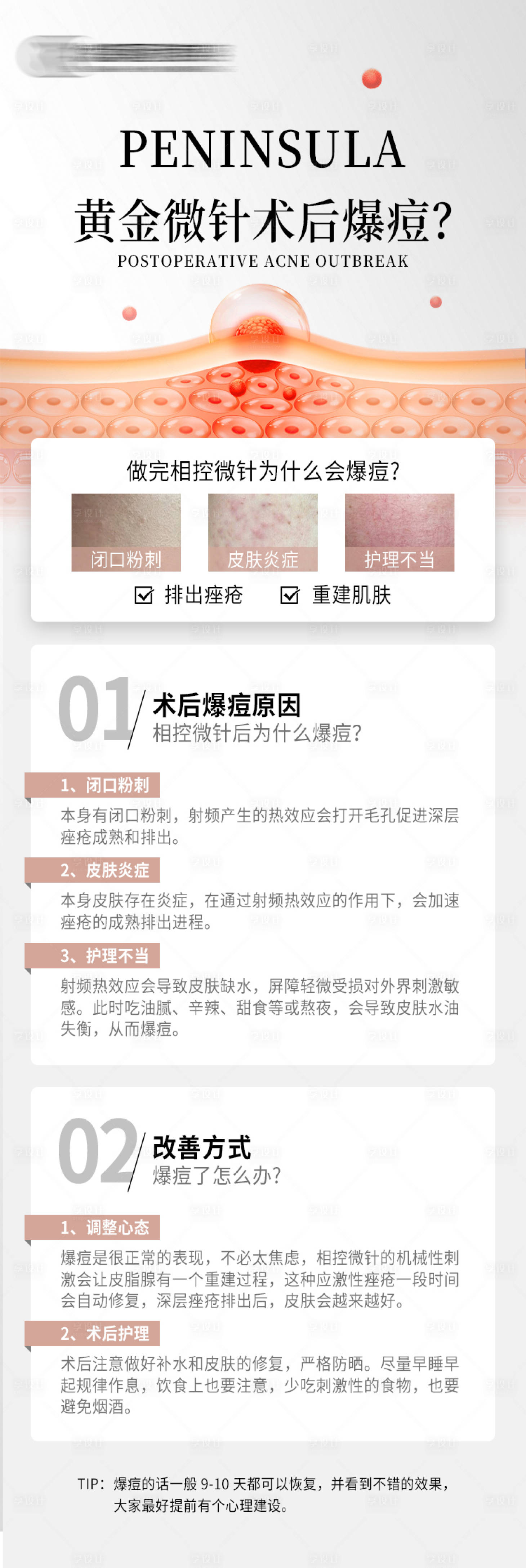 源文件下载【享设计】搜索编号：18340026318756868【黄金微针后爆痘科普海报】