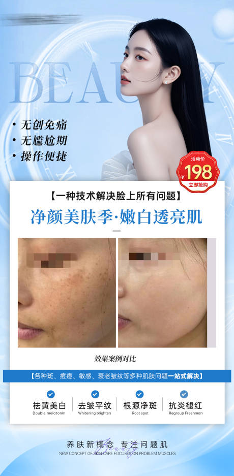 源文件下载【享设计】搜索编号：89680026066859706【医美案例效果宣传海报】