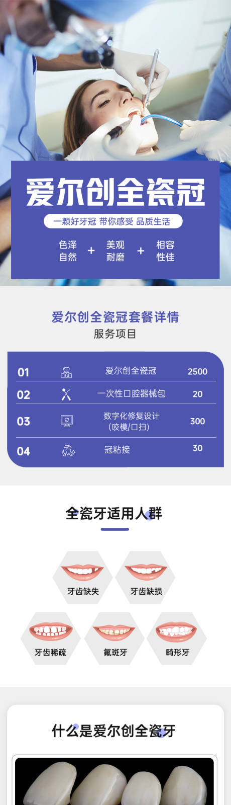 源文件下载【爱尔创全瓷牙冠详情页】编号：18920026250649779