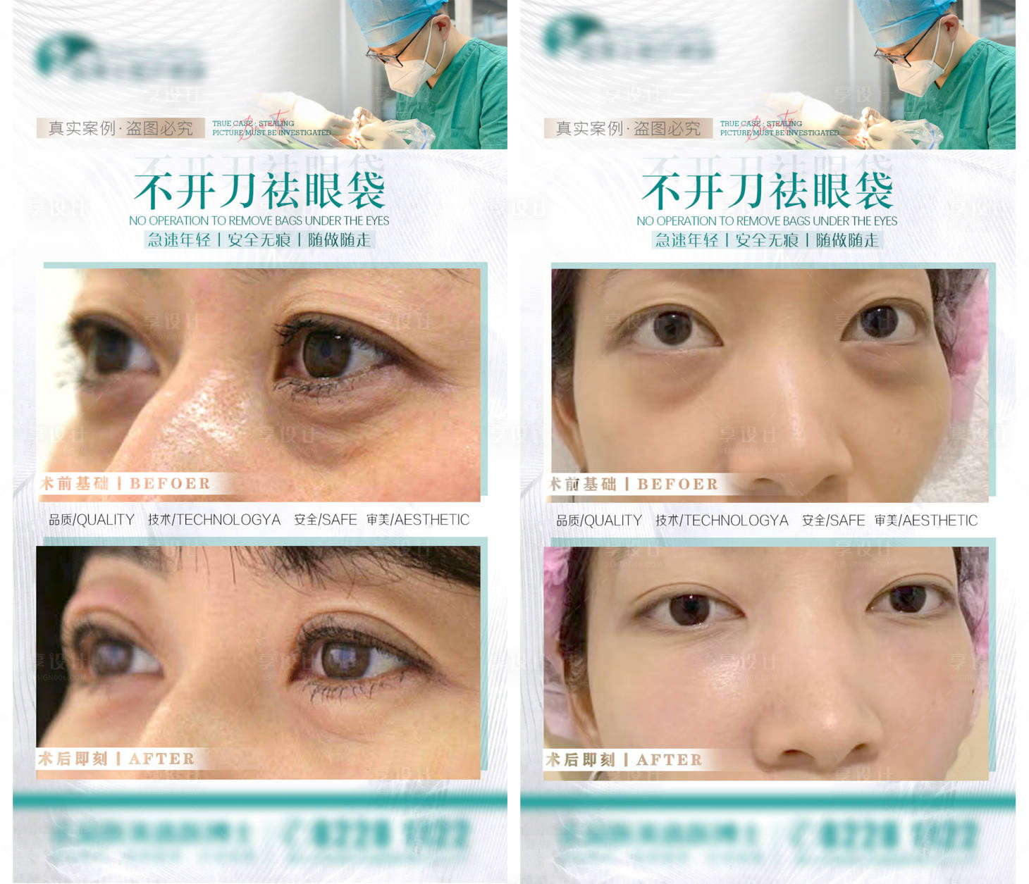 源文件下载【享设计】搜索编号：40950026414913530【医美案例祛眼袋分享】