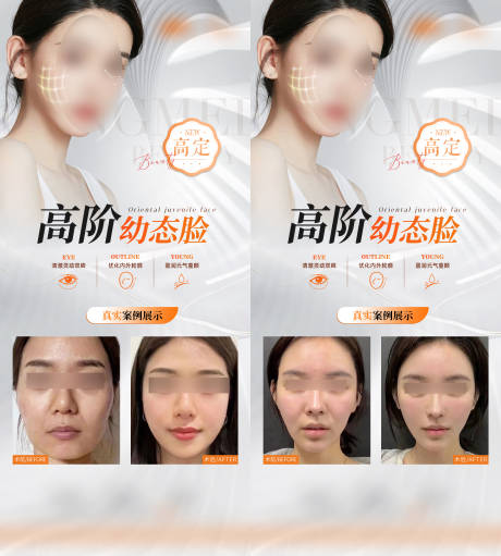 源文件下载【医美幼态脸案例海报】编号：70250026060795716