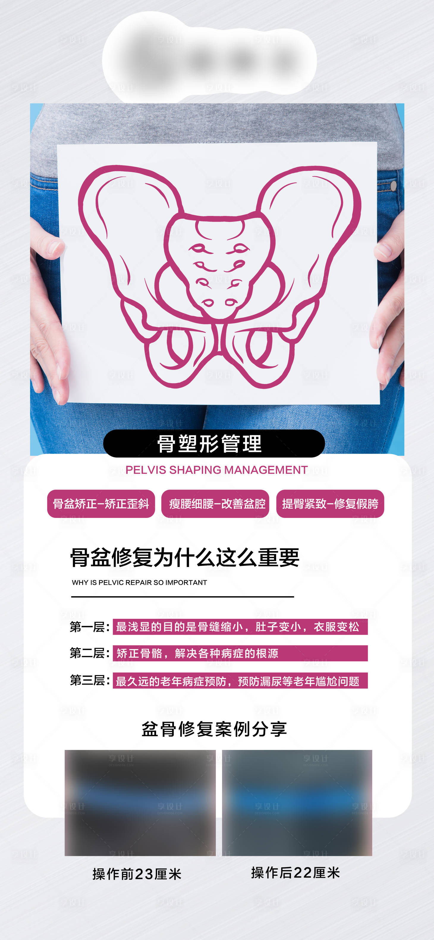 源文件下載【享設(shè)計(jì)】搜索編號：44310026373537256【私密產(chǎn)后修復(fù)】