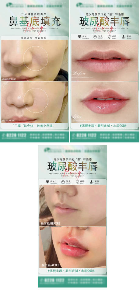 源文件下载【医美玻尿酸丰唇海报】编号：81930026414379497