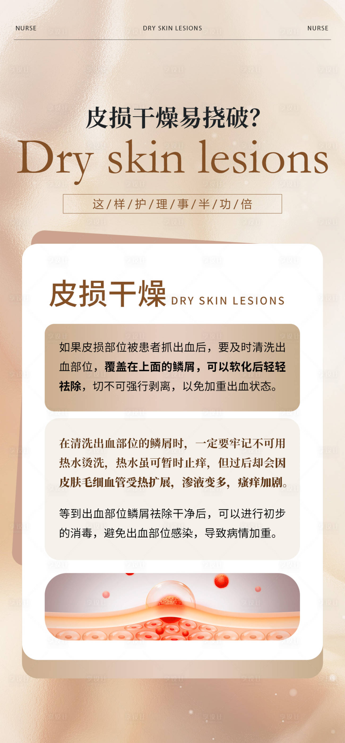 源文件下載【享設(shè)計(jì)】搜索編號(hào)：38810026337058991【皮膚病常識(shí)海報(bào)】