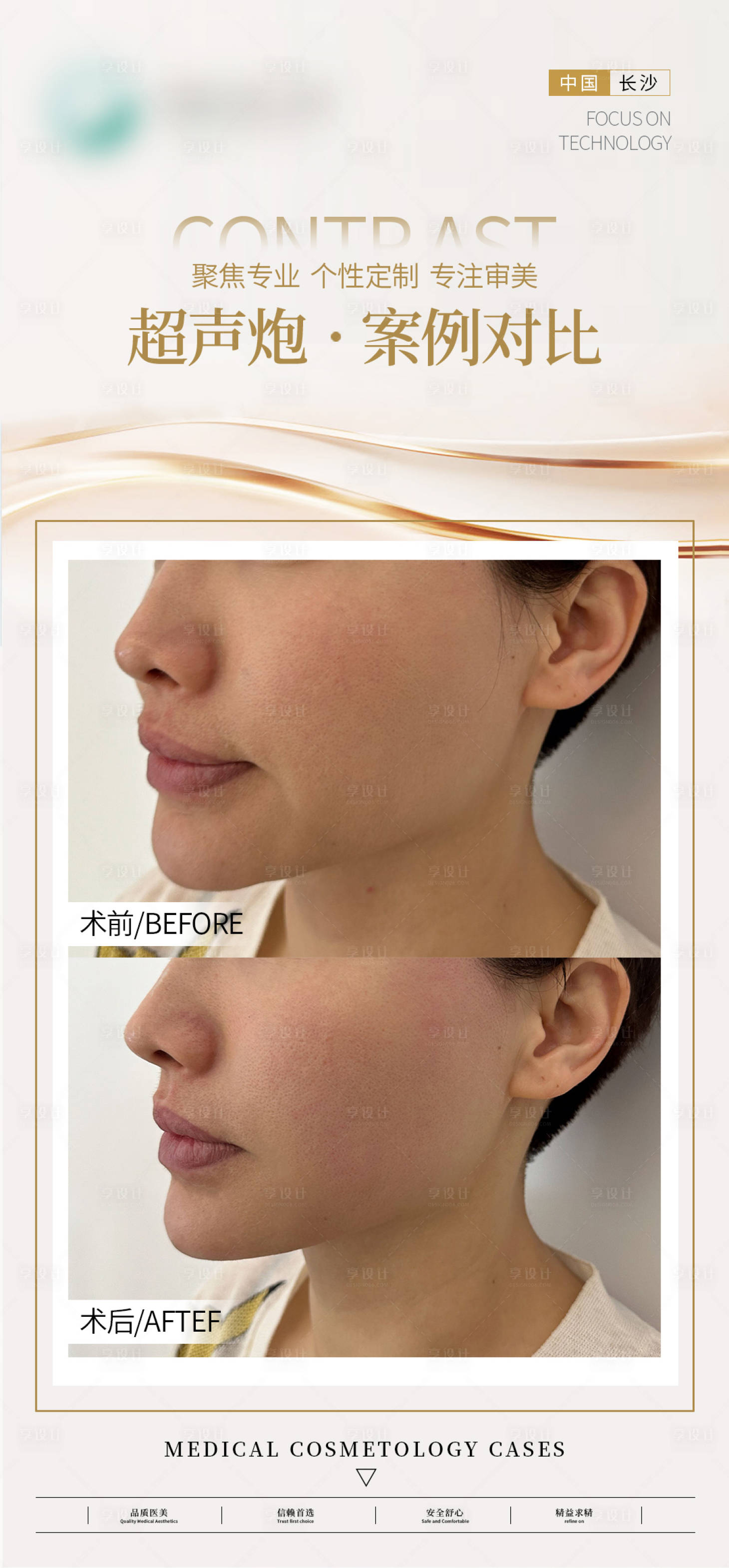 源文件下载【享设计】搜索编号：41490026522501565【医美超声炮案例海报】