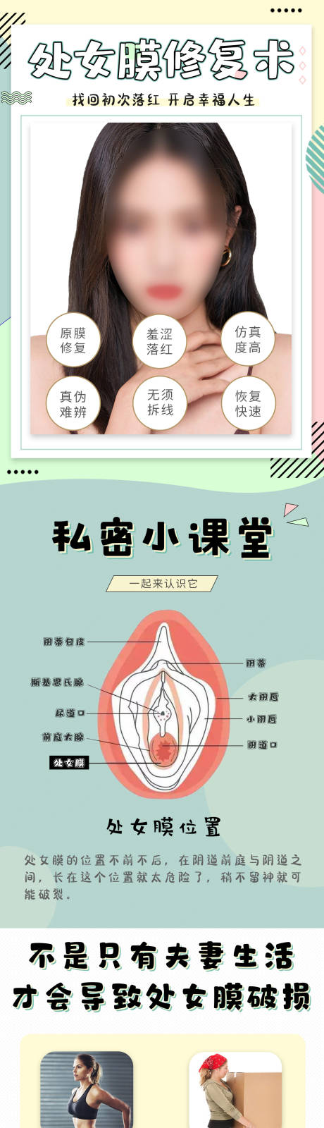 源文件下载【私密处女膜修复详情页】编号：48330026070354019