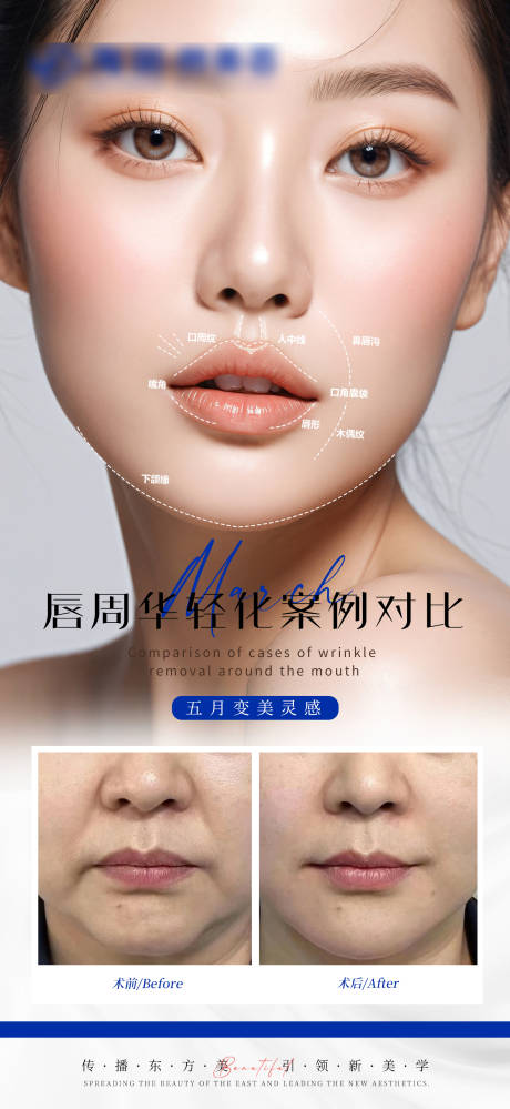 源文件下載【享設計】搜索編號：13690026331927586【醫美唇周抗衰案例對比海報】