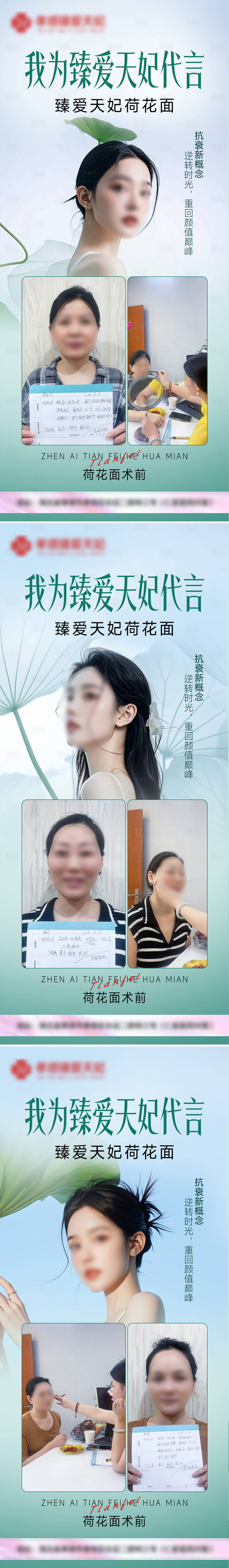 源文件下载【医美面部整形案例代言系列海报】编号：91430026023301301