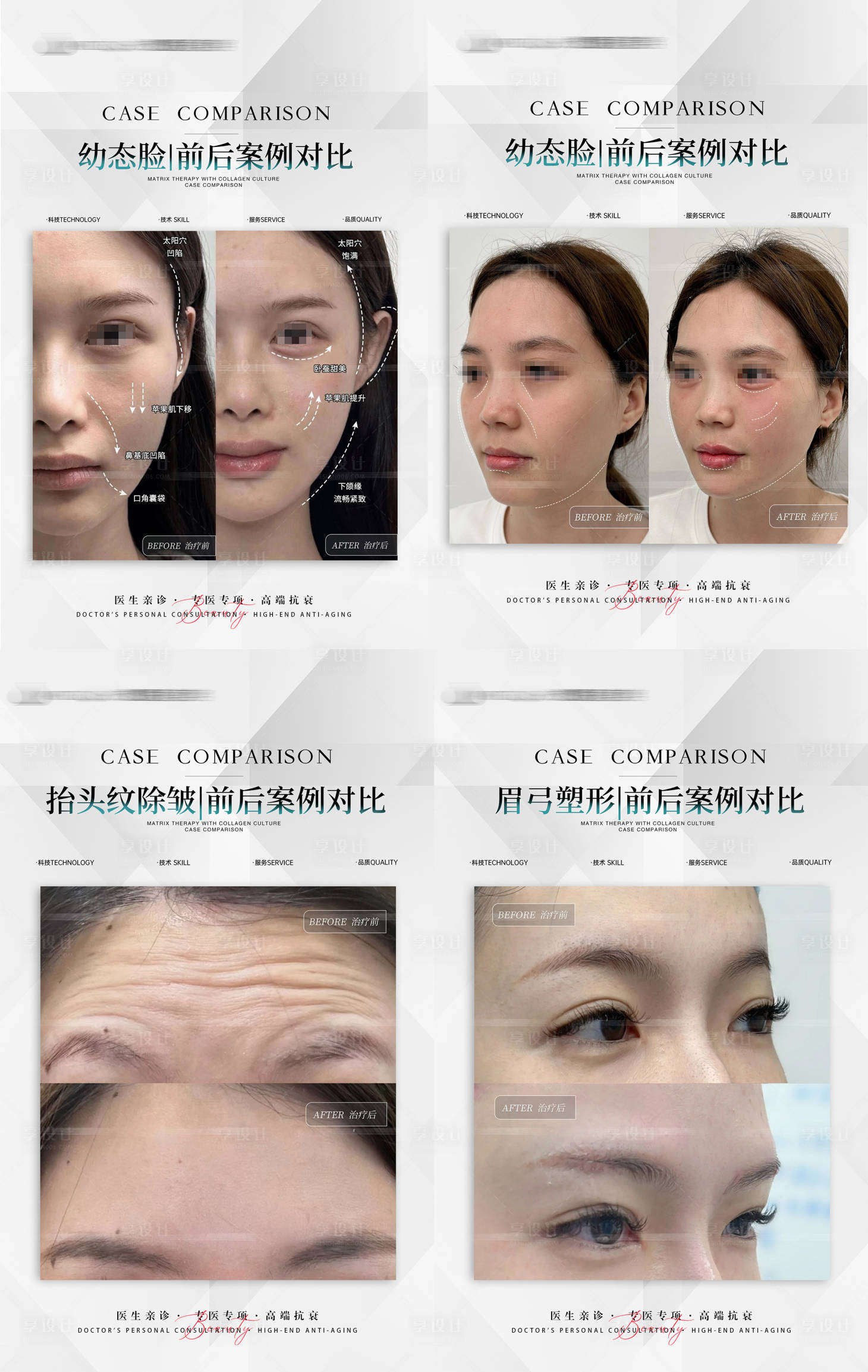 源文件下载【享设计】搜索编号：34630026117331362【医美案例对比海报】