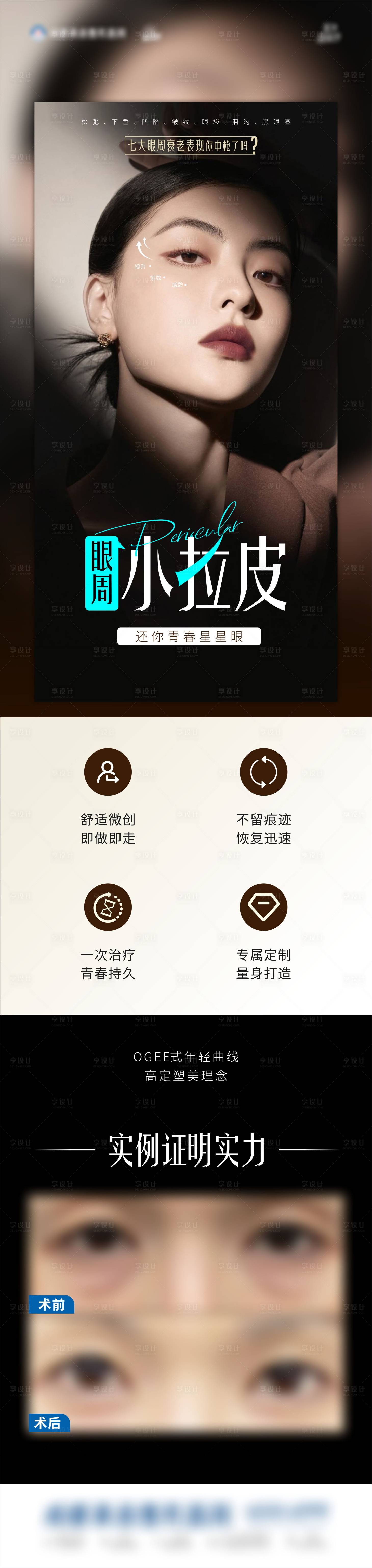 源文件下载【眼周抗衰小拉皮海报】编号：68940026397676232