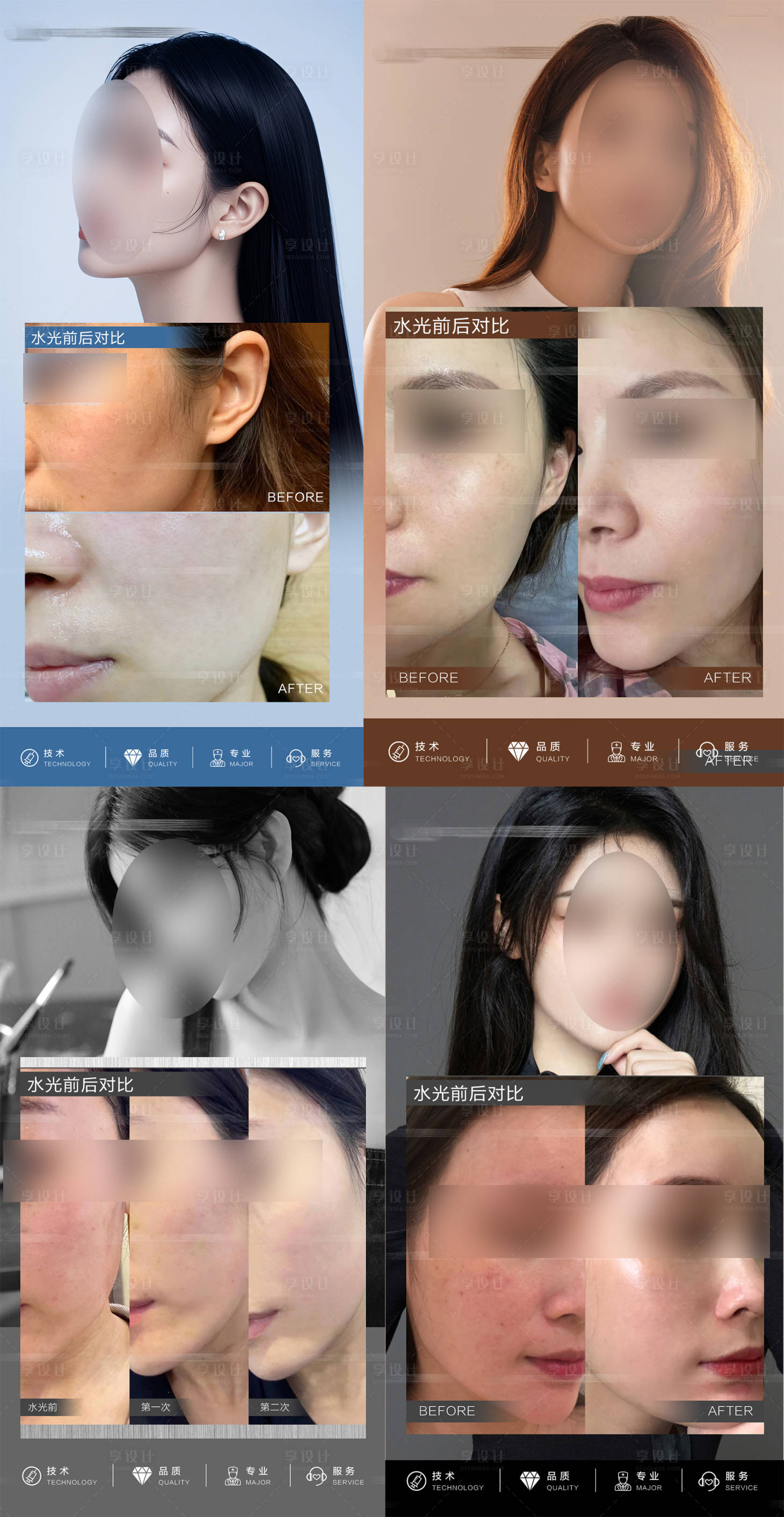 源文件下载【享设计】搜索编号：50350026139318139【医美水光针皮肤案例对比系列海报】