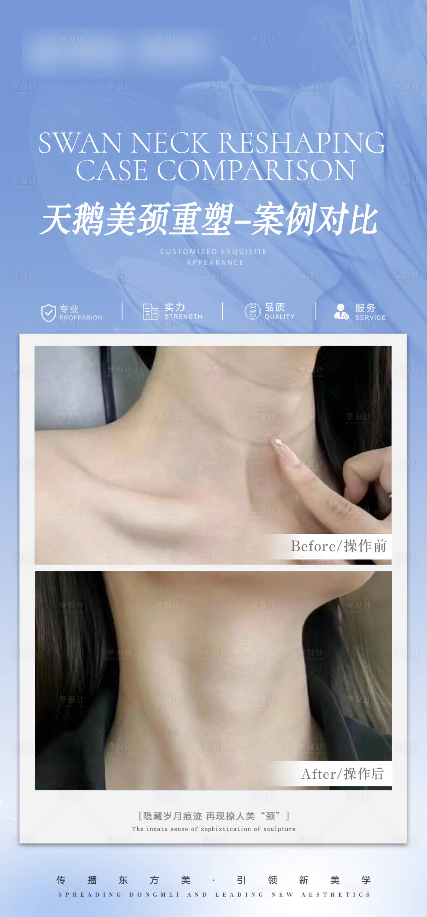 源文件下載【享設計】搜索編號：67230026282798373【醫(yī)美頸部抗衰案例對比海報】
