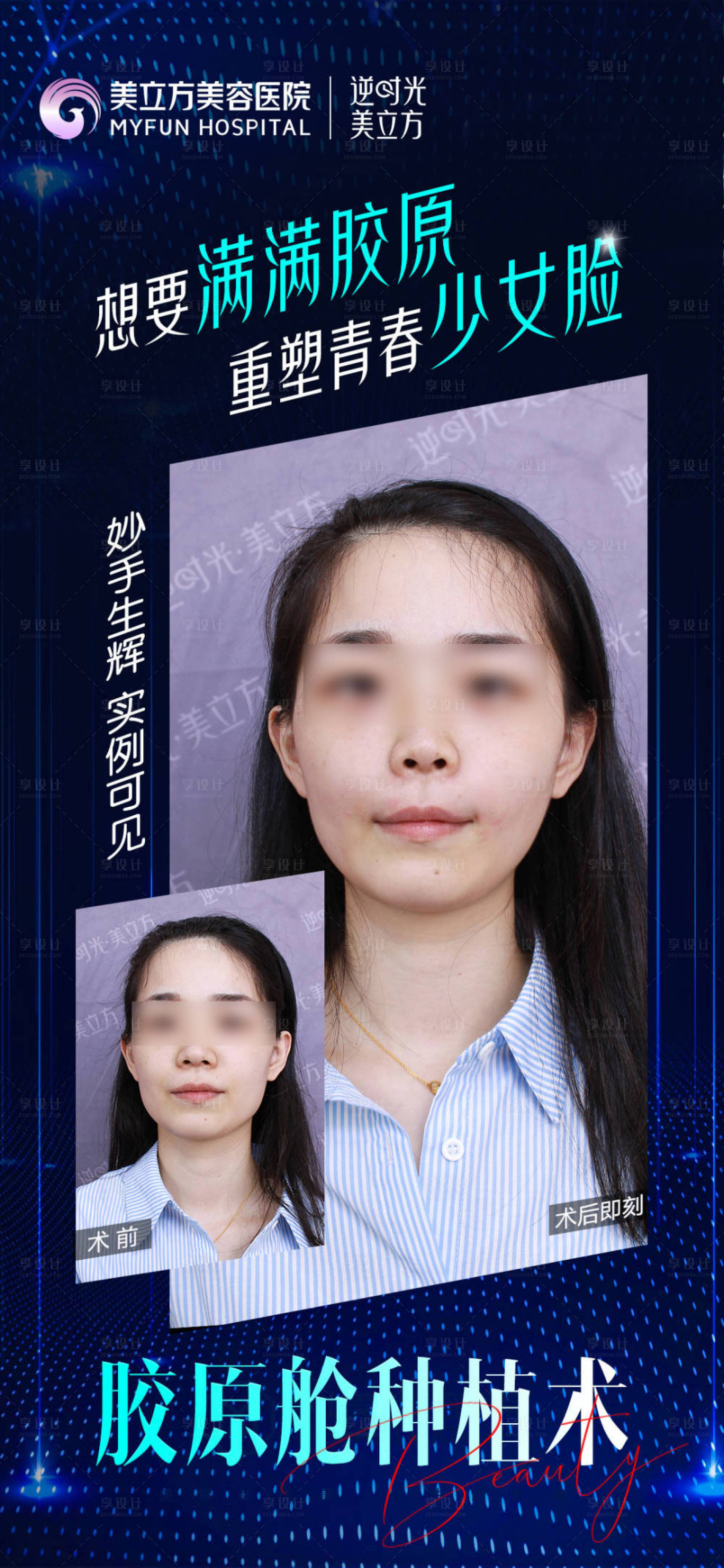 源文件下载【医美整形抗衰护肤案例对比海报】编号：43920026009907515