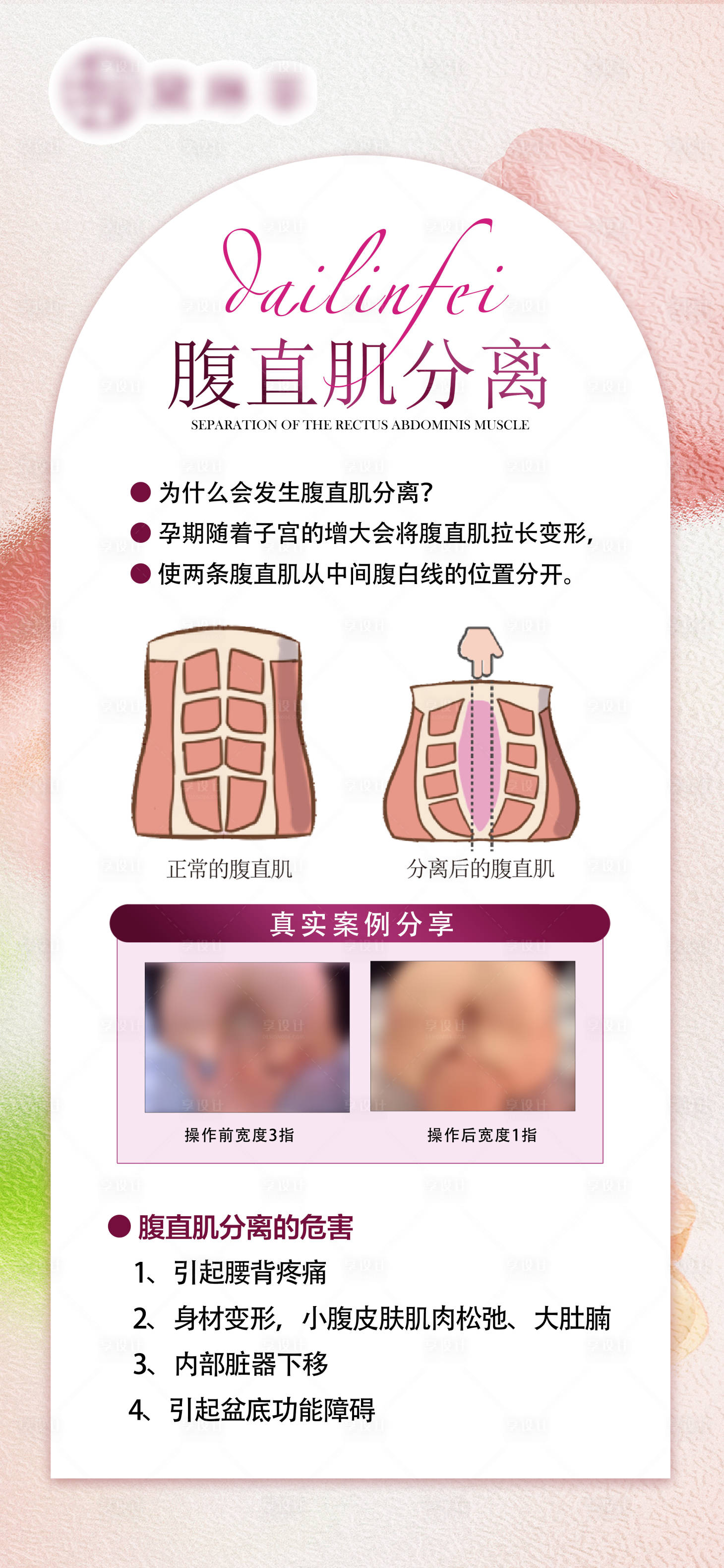 源文件下載【享設計】搜索編號：50920026372989022【私密產后修復案例】