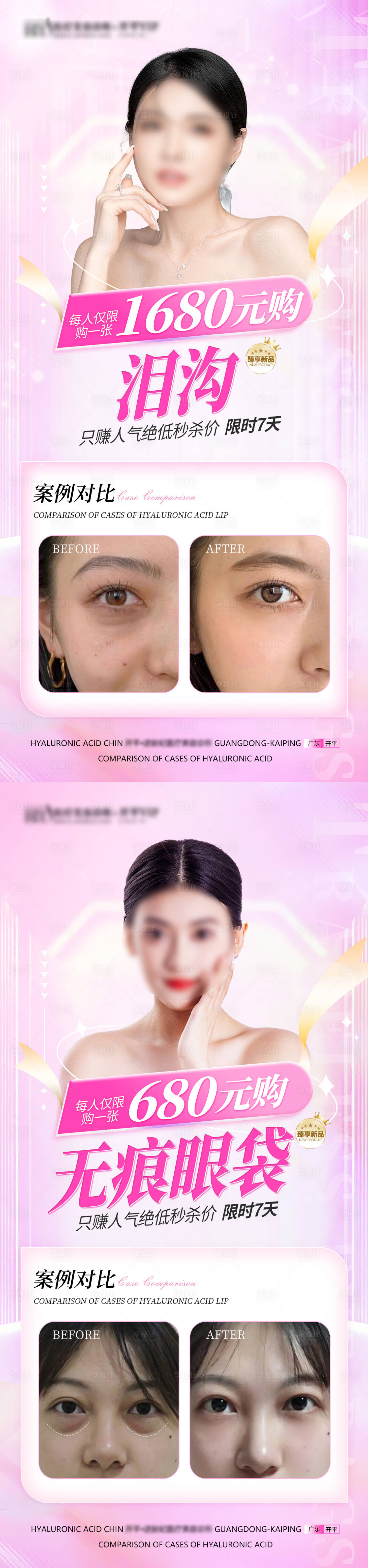 源文件下载【享设计】搜索编号：60490026362549153【医美祛眼袋海报】