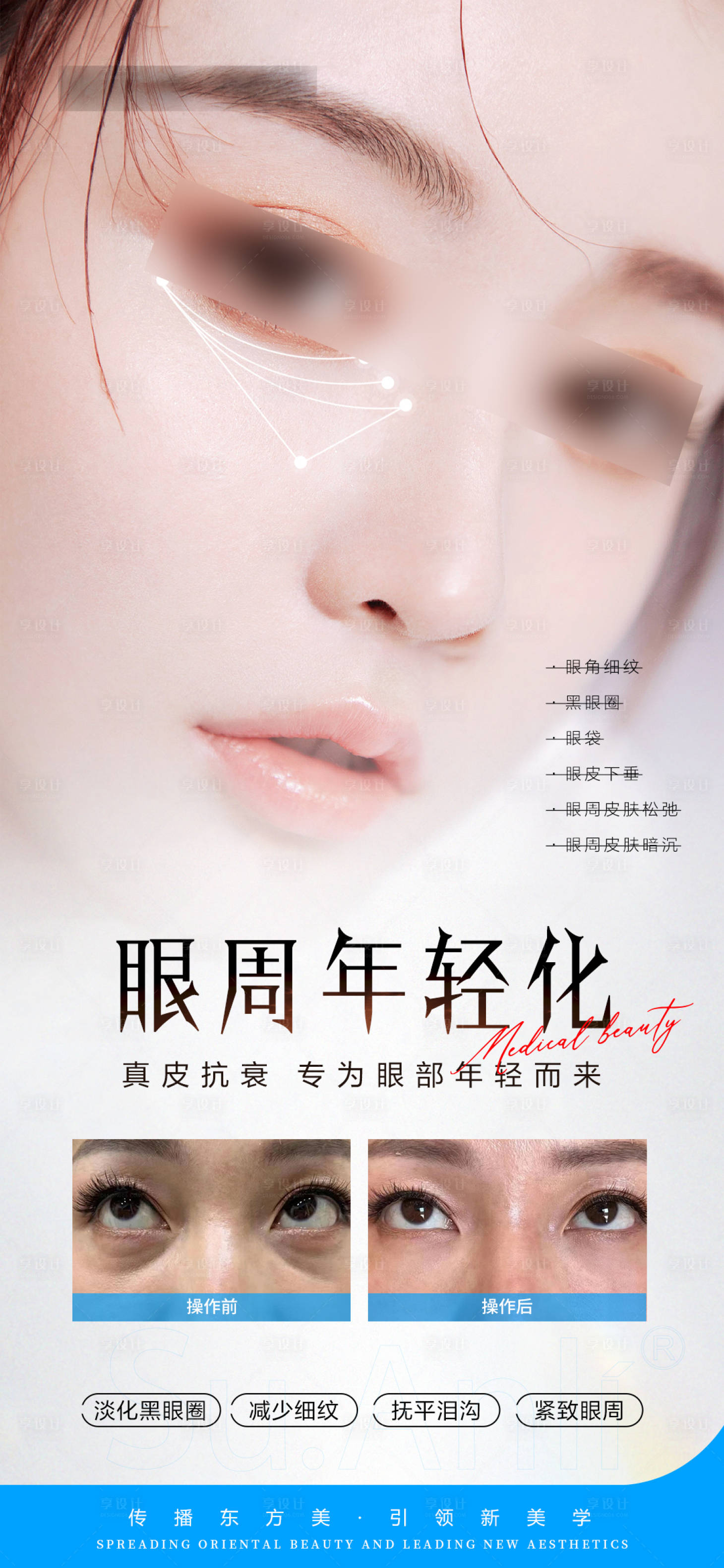 源文件下載【享設計】搜索編號：19690026458839503【醫美眼周抗衰案例對比海報】