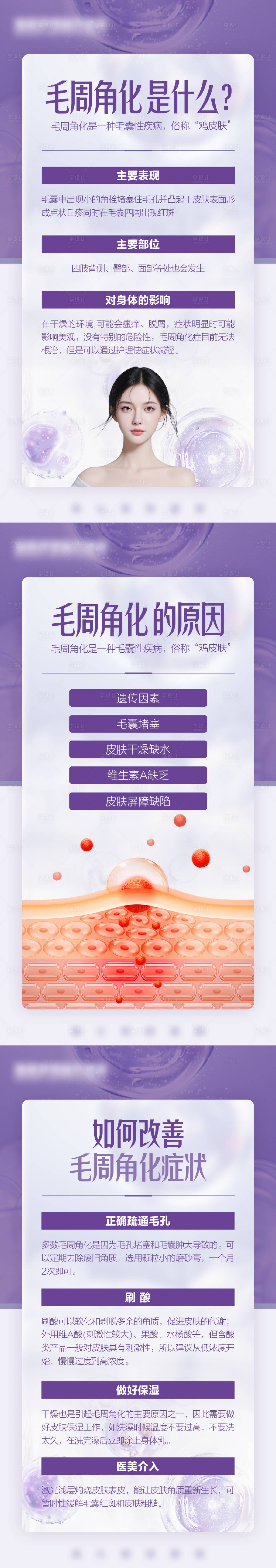 源文件下载【享设计】搜索编号：70320026549097218【毛周角化】