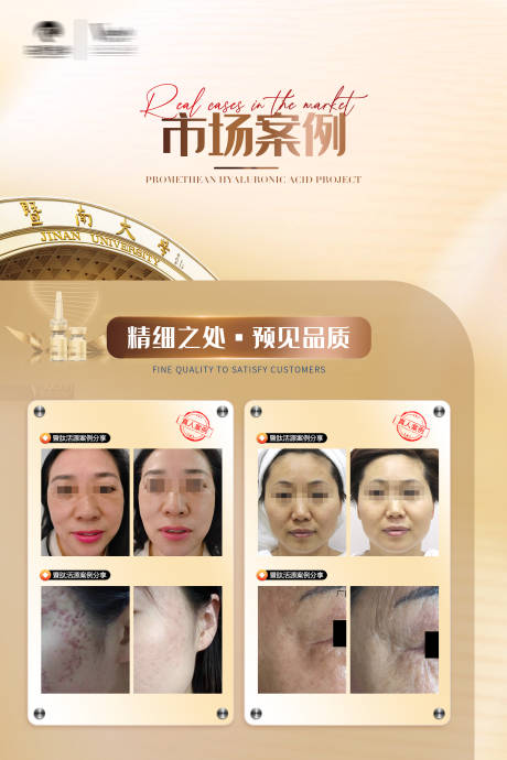源文件下載【享設(shè)計】搜索編號：21990026443162576【醫(yī)美案例分享海報展板】