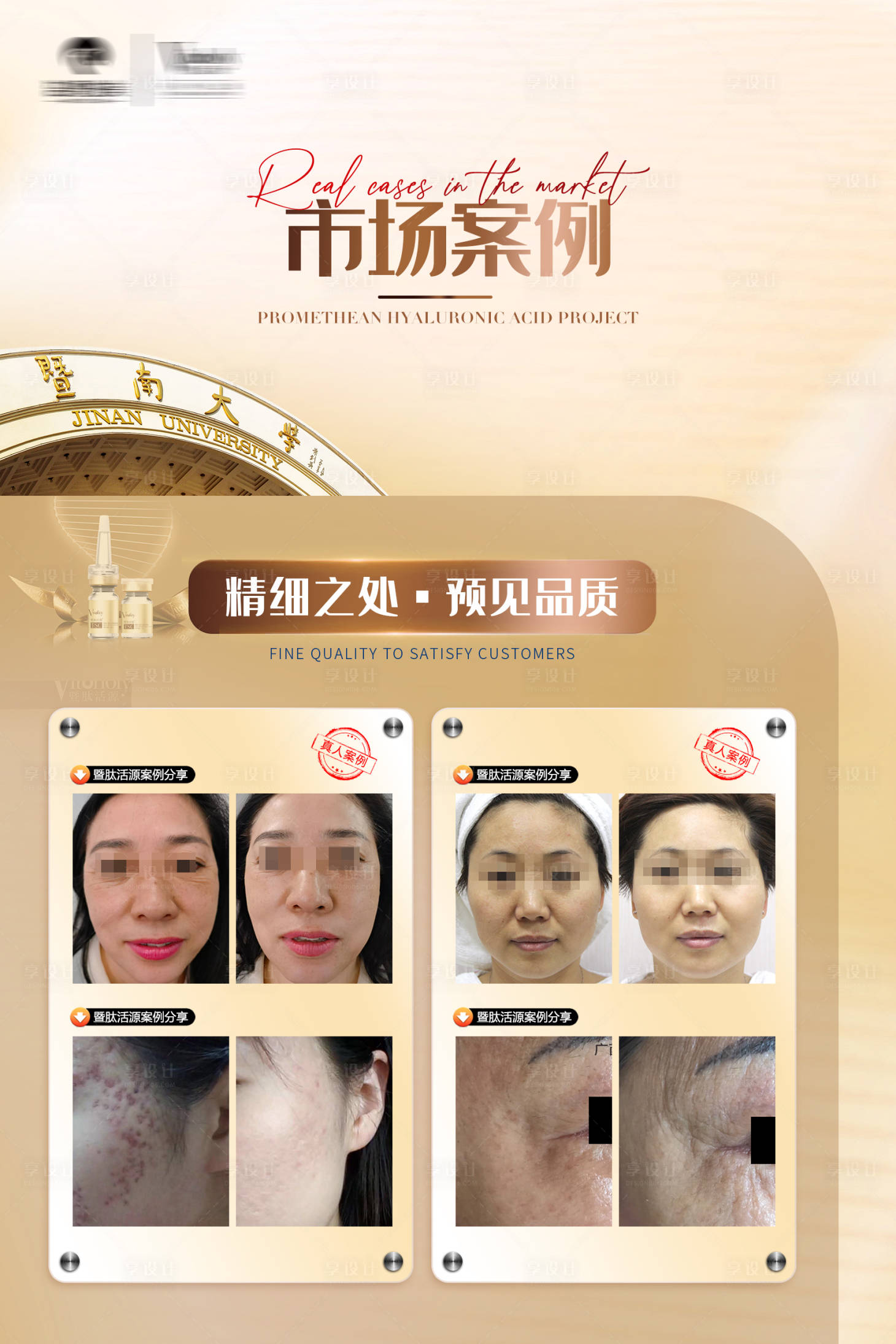 源文件下載【享設(shè)計】搜索編號：21990026443162576【醫(yī)美案例分享海報展板】