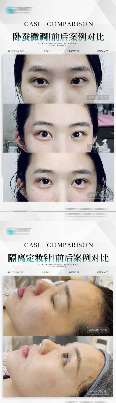 源文件下載【醫美水光臥蠶案例】編號：68420026164112685