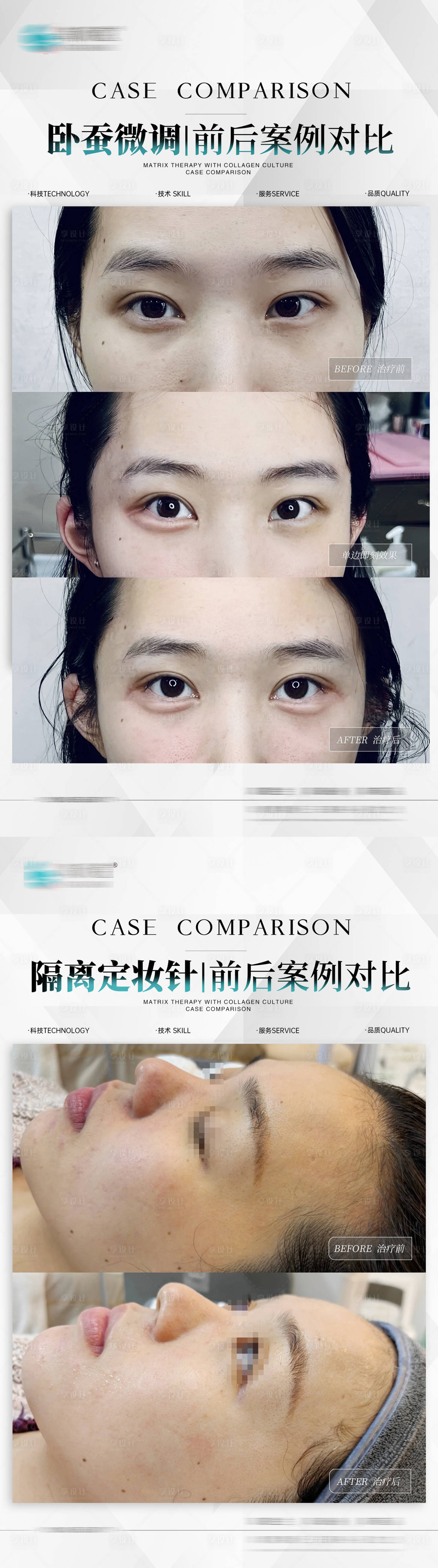 源文件下載【享設(shè)計(jì)】搜索編號(hào)：68420026164112685【醫(yī)美水光臥蠶案例】